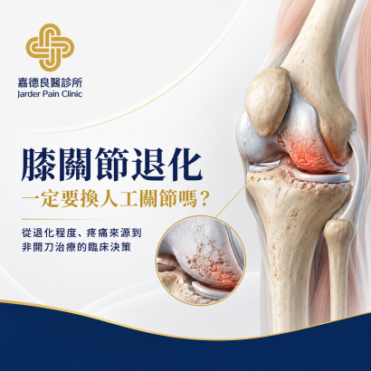 knee OA decision.png