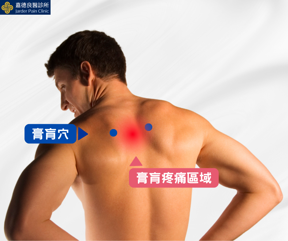 膏肓疼痛