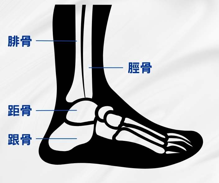踝關節疼痛