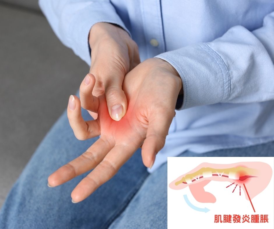 嘉德良醫診所板機指